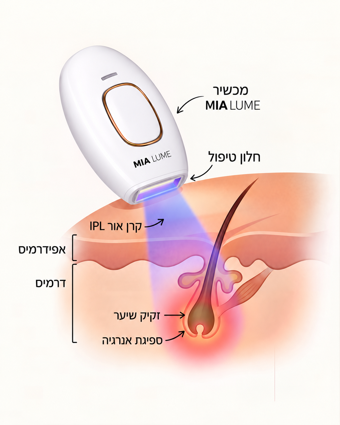 מה זה IPL?
