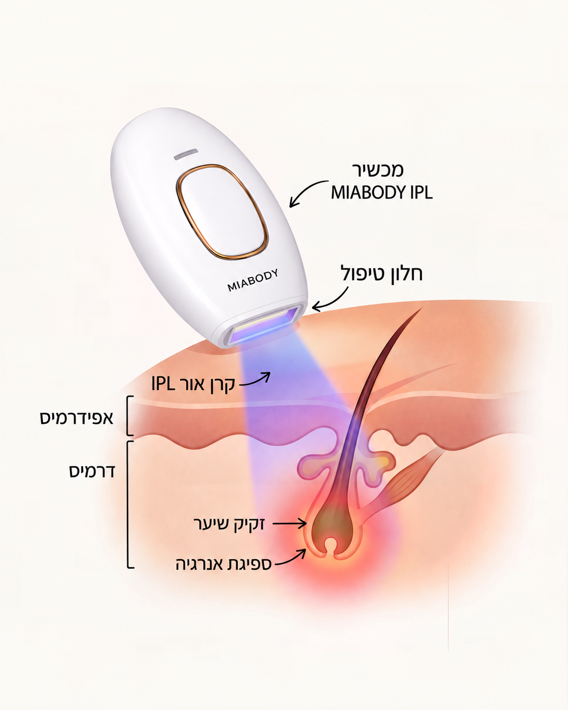 מה זה IPL?